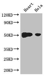 Western Blot Positive WB detected in: Mouse heart tissue, Hela whole cell lysate All lanes: TFDP2 antibody at 3.2ug/ml Secondary Goat polyclonal to rabbit IgG at 1/50000000 dilution Predicted band size: 50, 41, 42, 43, 40, 35, 47 kDa Observed band...
