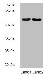 Western blot All lanes: CRMP1 antibody at 2µg/ml Lane 1: Rat brain tissue Lane 2: Mouse lung tissue Secondary Goat polyclonal to rabbit IgG at 1/10000 dilution Predicted band size: 63, 75 kDa Observed band size: 63 kDa