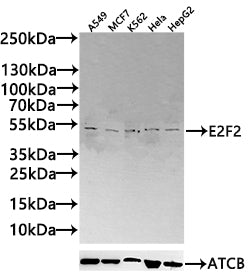 Western Blot Positive WB detected in: A549 whole cell lysate(20µg), MCF7 whole cell lysate(20µg), K562 whole cell lysate(20µg), Hela whole cell lysate(20µg), HepG2 whole cell lysate(20µg) All lanes:E2F2 antibody at 1:1000 Secondary Goat polyclonal...