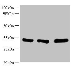 Western blot All lanes: EIF2B1 antibody at 5.14µg/ml Lane 1: K562 whole cell lysate Lane 2: Mouse brain tissue Lane 3: Jurkat whole cell lysate Secondary Goat polyclonal to rabbit IgG at 1/10000 dilution Predicted band size: 34, 25 kDa Observed ba...