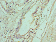 Immunohistochemistry of paraffin-embedded human prostate tissue using CSB-PA623927ESR1HU at dilution of 1:100