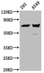 Western Blot Positive WB detected in: 293 whole cell lysate, A549 whole cell lysate All lanes: PLS1 antibody at 5.2µg/ml Secondary Goat polyclonal to rabbit IgG at 1/50000 dilution Predicted band size: 71 kDa Observed band size: 71 kDa