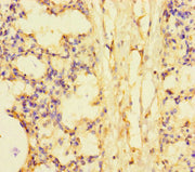 Immunohistochemistry of paraffin-embedded human lung tissue using CSB-PA623935LA01HU at dilution of 1:100