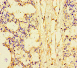 Immunohistochemistry of paraffin-embedded human lung tissue using CSB-PA623935LA01HU at dilution of 1:100