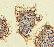 Immunohistochemistry of paraffin-embedded human small intestine tissue using CSB-PA623954LA01HU at dilution of 1:100