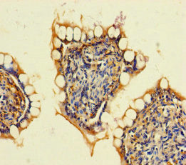 Immunohistochemistry of paraffin-embedded human small intestine tissue using CSB-PA623954LA01HU at dilution of 1:100