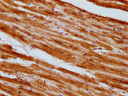 IHC image of CSB-PA624015LA01HU diluted at 1:300 and staining in paraffin-embedded human heart tissue performed on a Leica BondTM system. After dewaxing and hydration, antigen retrieval was mediated by high pressure in a citrate buffer (pH 6.0). S...