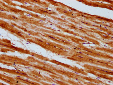 IHC image of CSB-PA624015LA01HU diluted at 1:300 and staining in paraffin-embedded human heart tissue performed on a Leica BondTM system. After dewaxing and hydration, antigen retrieval was mediated by high pressure in a citrate buffer (pH 6.0). S...