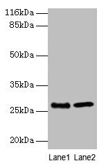 Western blot All lanes: EBP antibody at 2µg/ml Lane 1: A549 whole cell lysate Lane 2: 293T whole cell lysate Secondary Goat polyclonal to rabbit IgG at 1/10000 dilution Predicted band size: 27 kDa Observed band size: 27 kDa