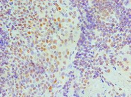 Immunohistochemistry of paraffin-embedded human tonsil tissue using CSB-PA624018ESR2HU at dilution of 1:100