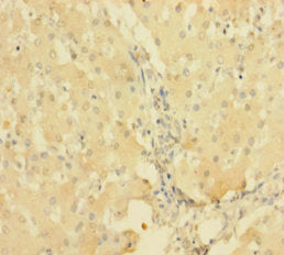 Immunohistochemistry of paraffin-embedded human liver tissue using CSB-PA624019LA01HU at dilution of 1:100