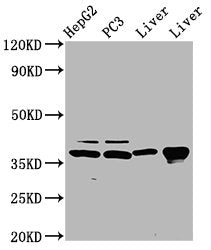Western Blot Positive WB detected in: HepG2 whole cell lysate, PC-3 whole cell lysate, Rat liver tissue, Mouse liver tissue All lanes: E2F5 antibody at 5µg/ml Secondary Goat polyclonal to rabbit IgG at 1/50000 dilution Predicted band size: 38, 21...