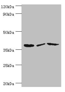 Western blot All lanes: P2RY14 antibody at 12ug/ml Lane 1: Mouse heart tissue Lane 2: Mouse stomach tissue Lane 3: Mouse small intestine tissue Secondary Goat polyclonal to rabbit IgG at 1/10000 dilution Predicted band size: 39 kDa Observed band s...