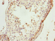 Immunohistochemistry of paraffin-embedded human testis tissue using CSB-PA624027DSR1HU at dilution of 1:100