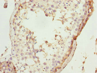 Immunohistochemistry of paraffin-embedded human testis tissue using CSB-PA624027DSR1HU at dilution of 1:100