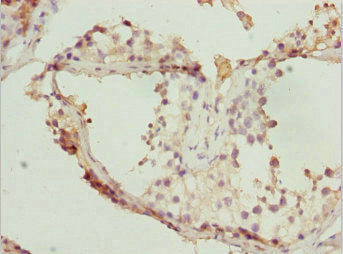 Immunohistochemistry of paraffin-embedded human testis tissue using CSB-PA624027DSR2HU at dilution of 1:100