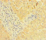 Immunohistochemistry of paraffin-embedded human liver tissue using CSB-PA624030HA01HU at dilution of 1:100