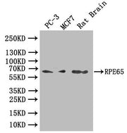 Western Blot Positive WB detected in: PC-3 whole cell lysate, MCF7 whole cell lysate, Rat Brain tissue lysate All lanes: RPE65 antibody at 1:1000 Secondary Goat polyclonal to rabbit IgG at 1/50000 dilution Predicted band size: 61, 65 kDa Observed...