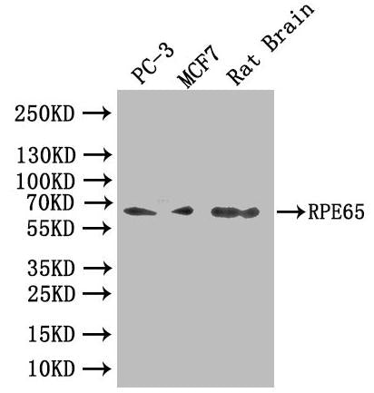 Western Blot Positive WB detected in: PC-3 whole cell lysate, MCF7 whole cell lysate, Rat Brain tissue lysate All lanes: RPE65 antibody at 1:1000 Secondary Goat polyclonal to rabbit IgG at 1/50000 dilution Predicted band size: 61, 65 kDa Observed...