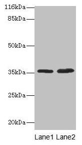 Western blot All lanes: ACKR1 antibody at 2µg/ml Lane 1: Mouse kidney tissue Lane 2: Mouse spleen tissue Secondary Goat polyclonal to rabbit IgG at 1/10000 dilution Predicted band size: 36 kDa Observed band size: 36 kDa