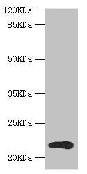 Western blot All lanes: TPD52L1 antibody at 1.31µg/ml + MCF-7 whole cell lysate Secondary Goat polyclonal to rabbit IgG at 1/10000 dilution Predicted band size: 23, 17, 15, 12, 20 kDa Observed band size: 23 kDa