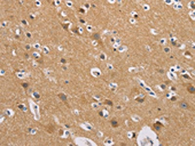 The image on the left is immunohistochemistry of paraffin-embedded Human brain tissue using CSB-PA627130(GNB5 Antibody) at dilution 1/20, on the right is treated with fusion protein. (Original magnification: ×200)