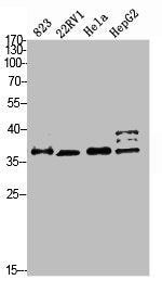 Western blot analysis of 823 22RV1 HELA HEPG2 Cell Lysate, antibody was diluted at 1:2000. Secondary antibody was diluted at 1:20000