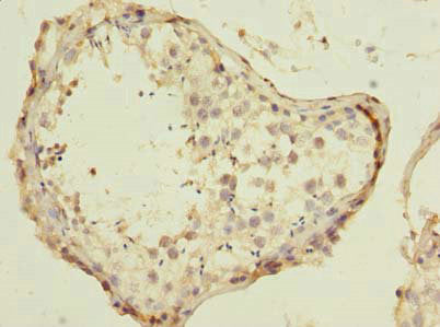 Immunohistochemistry of paraffin-embedded human testis tissue using CSB-PA632275LA01HU at dilution of 1:100