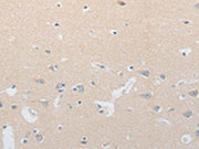 The image on the left is immunohistochemistry of paraffin-embedded Human brain tissue using CSB-PA633834(NOTCH2 Antibody) at dilution 1/20, on the right is treated with synthetic peptide. (Original magnification: ×200)