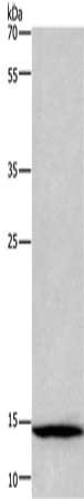 Gel: 10%SDS-PAGE, Lysate: 40 ug, Lane: Mouse gullet tissue, Primary antibody: CSB-PA633974(CSTA Antibody) at dilution 1/300, Secondary antibody: Goat anti rabbit IgG at 1/8000 dilution, Exposure time: 10 minutes