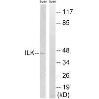 Western blot analysis of extracts from rat liver cells, using ILK (Ab-246) antibody.