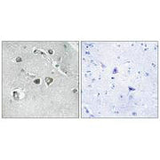 Immunohistochemistry analysis of paraffin-embedded human brain tissue, using Collagen XI α2 antibody.