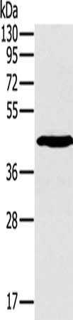 Gel: 8%SDS-PAGE, Lysate: 50 ug, Lane: Jurkat cells, Primary antibody: CSB-PA634321(SLAMF1 Antibody) at dilution 1/200, Secondary antibody: Goat anti rabbit IgG at 1/8000 dilution, Exposure time: 1 minute