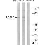 Western blot analysis of extracts from COLO cells and Jurkat cells, using ACSL6 antibody.