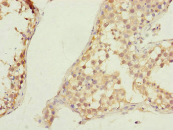 Immunohistochemistry of paraffin-embedded human testis tissue using CSB-PA635936DSR1HU at dilution of 1:100