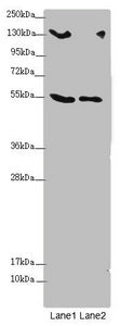 Western blot All lanes: CSPP1 antibody at 1.53 ug/ml Lane 1: 293T whole cell lysate Lane 2: Jurkat whole cell lysate Secondary Goat polyclonal to rabbit IgG at 1/10000 dilution Predicted band size: 146, 142, 102 kDa Observed band size: 146, 75, 55...