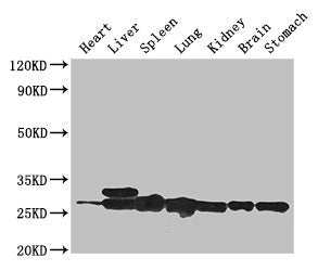 Western Blot Positive WB detected in: Mouse heart tissue, Mouse liver tissue, Mouse spleen tissue, Mouse lung tissue, Mouse kidney tissue, Mouse brain tissue, Mouse stomach tissue All lanes: SWI5 antibody at 3ug/ml Secondary Goat polyclonal to rab...