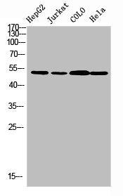 Western blot analysis of HepG2 JK Colo Hela using TRMT11 antibody.. Secondary antibody was diluted at 1:20000