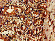 Immunohistochemistry of paraffin-embedded human small intestine tissue using CSB-PA640913LA01HU at dilution of 1:100