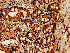 Immunohistochemistry of paraffin-embedded human small intestine tissue using CSB-PA640913LA01HU at dilution of 1:100