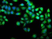 Immunofluorescence staining of Hela cells with CSB-PA640939LA01HU at 1:100, counter-stained with DAPI. The cells were fixed in 4% formaldehyde, permeabilized using 0.2% Triton X-100 and blocked in 10% normal Goat Serum. The cells were then incubat...