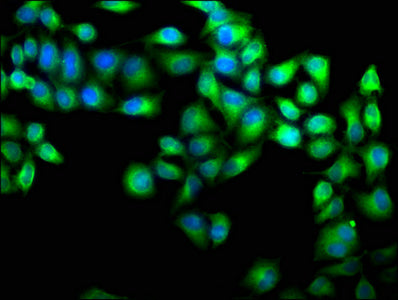 Immunofluorescence staining of Hela cells with CSB-PA640939LA01HU at 1:100, counter-stained with DAPI. The cells were fixed in 4% formaldehyde, permeabilized using 0.2% Triton X-100 and blocked in 10% normal Goat Serum. The cells were then incubat...