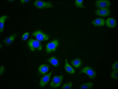 Immunofluorescence staining of A549 cells with CSB-PA642654LA01HU at 1:166, counter-stained with DAPI. The cells were fixed in 4% formaldehyde, permeabilized using 0.2% Triton X-100 and blocked in 10% normal Goat Serum. The cells were then incubat...