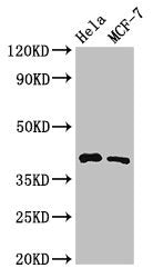 Western Blot Positive WB detected in: Hela whole cell lysate, MCF-7 whole cell lysate All lanes: HLA-B antibody at 3.2µg/ml Secondary Goat polyclonal to rabbit IgG at 1/50000 dilution Predicted band size: 41 kDa Observed band size: 41 kDa
