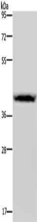 Gel: 8%SDS-PAGE, Lysate: 40 ug, Lane: Human lymphoma tissue, Primary antibody: CSB-PA644750(CSF2RA Antibody) at dilution 1/200, Secondary antibody: Goat anti rabbit IgG at 1/8000 dilution, Exposure time: 30 seconds