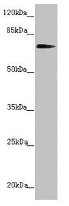 Western blot All lanes: KIZ antibody at 2.41µg/ml + Hela whole cell lysate Secondary Goat polyclonal to rabbit IgG at 1/10000 dilution Predicted band size: 76, 63, 70, 74, 60 kDa Observed band size: 76 kDa