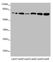Western blot All lanes: KIZ antibody at 2.89µg/ml Lane 1: HepG2 whole cell lysate Lane 2: A549 whole cell lysate Lane 3: CEM whole cell lysate Lane 4: Hela whole cell lysate Lane 5: Jurkat whole cell lysate Lane 6: 293T whole cell lysate Secondary...