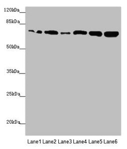 Western blot All lanes: KIZ antibody at 2.89µg/ml Lane 1: HepG2 whole cell lysate Lane 2: A549 whole cell lysate Lane 3: CEM whole cell lysate Lane 4: Hela whole cell lysate Lane 5: Jurkat whole cell lysate Lane 6: 293T whole cell lysate Secondary...