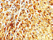 IHC image of CSB-PA647192LA01HU diluted at 1:250 and staining in paraffin-embedded human adrenal gland tissue performed on a Leica BondTM system. After dewaxing and hydration, antigen retrieval was mediated by high pressure in a citrate buffer (pH...