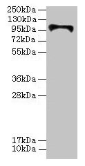 Western blot All lanes: HKDC1 antibody at 4µg/ml + U87 whole cell lysate Secondary Goat polyclonal to rabbit IgG at 1/10000 dilution Predicted band size: 103, 91, 83 kDa Observed band size: 103 kDa